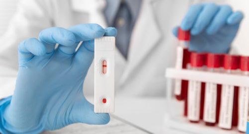 Новосибирцы могут бесплатно провериться на наличие ВИЧ-инфекции и гепатита С